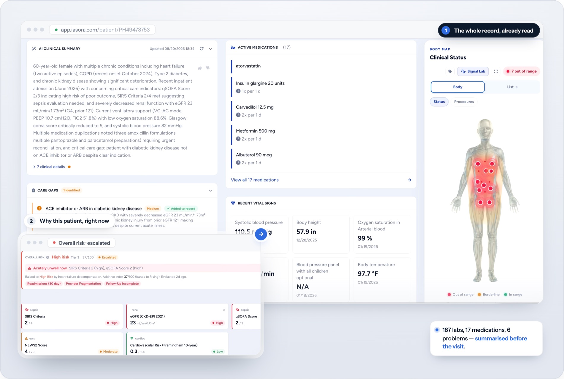 A Patient 360 view with an AI clinical summary, active medications, a body map, care gaps and risk scores.