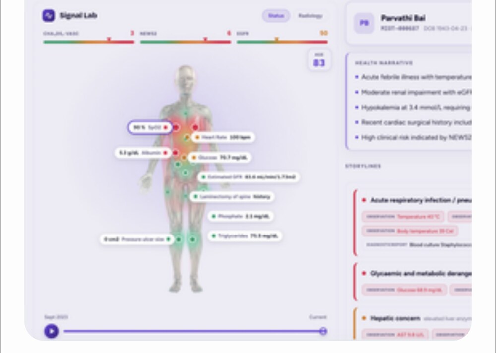 Signal Lab State anatomical body map with risk overlay and evidence-linked storylines